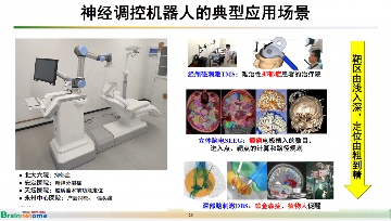 脑健康创新医疗器械研发加速中国医疗技术突破(图10)