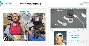 植入式脑机接口，开启意识与AI融合的可能性