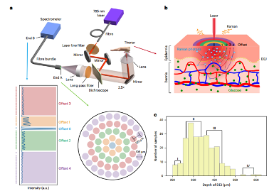 瑞金医院突破无创血糖检测技术难题，告别扎手指测血糖时代(图3)